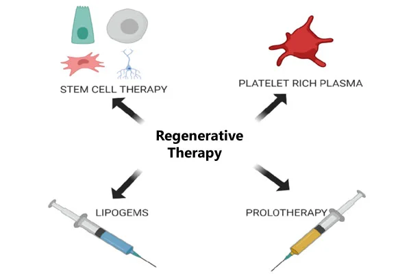 Regenerative Therapy