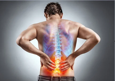 Low Back Pain