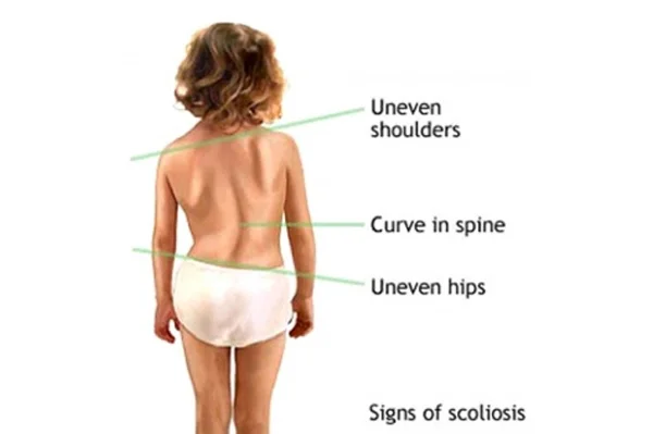 Deformity Correction