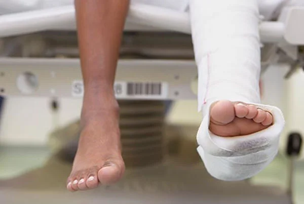Limb Fracture