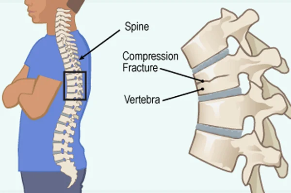 Fracture Clinic